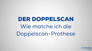 DER DOPPELSCAN – Wie matche ich die Doppelscan-Prothese
